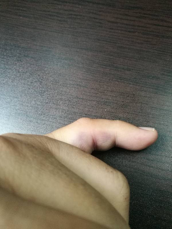IMG_20180702_075122.jpg