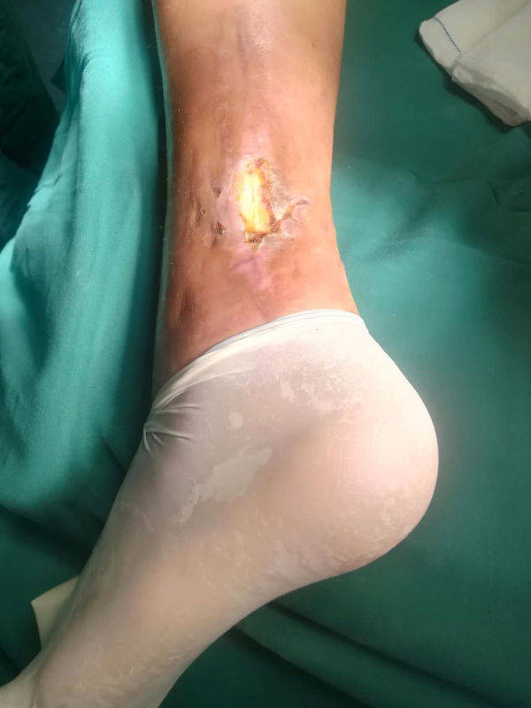 104624