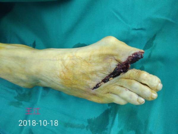 IMG_20181020_092652.jpg