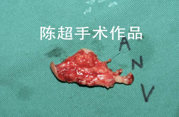 屏幕快照 2018-12-27 下午10.22.48.png