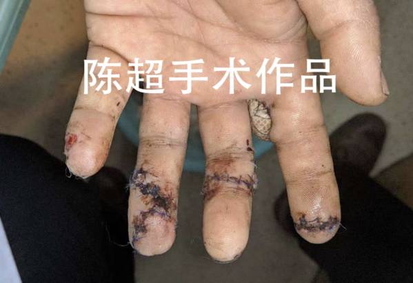 屏幕快照 2018-12-27 下午10.23.15.png