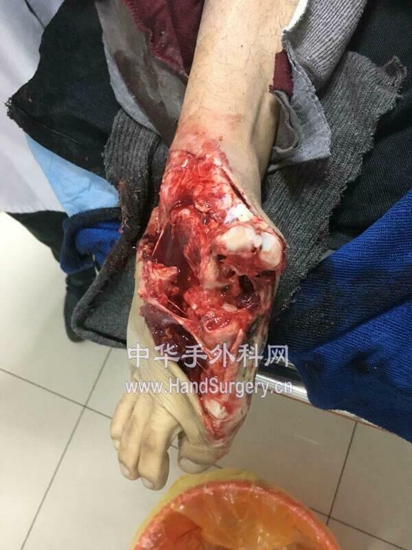 微信图片_20180204181951.jpg