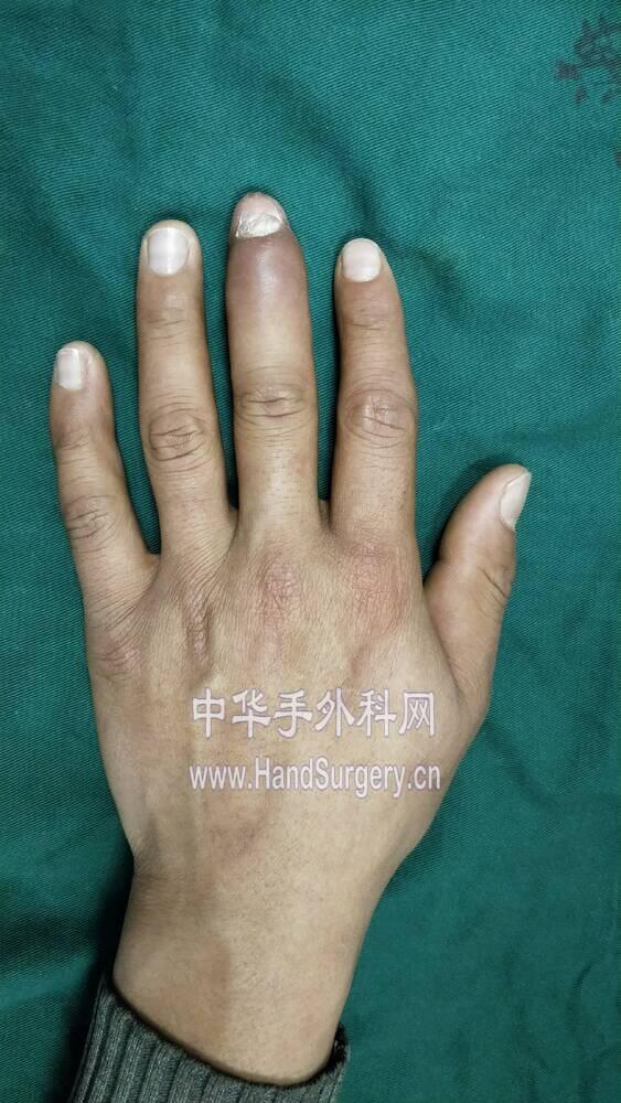 IMG20180224090535.jpg
