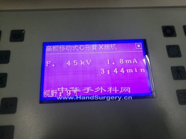 IMG_20190825_175624.jpg