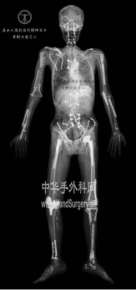 微信截图_20190924075700.png