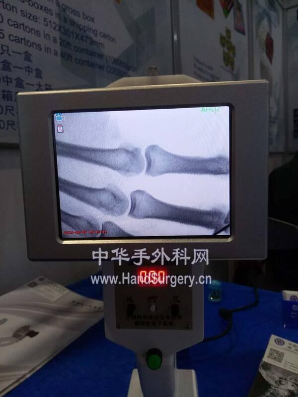 手指.jpg