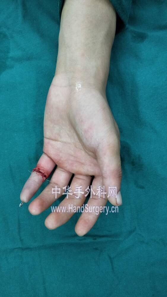 IMG20180630060917.jpg