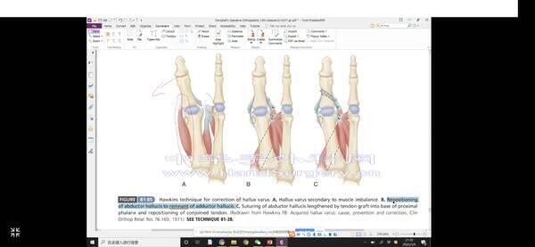 Screenshot_20200306_213103_com.camicrosurgeon.yyh.jpg