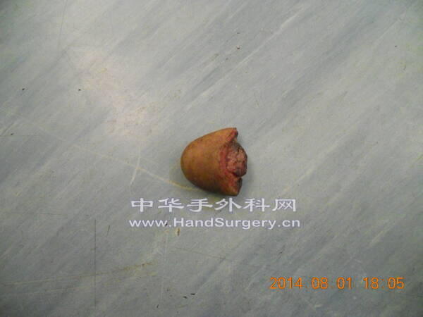术前