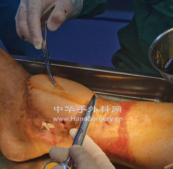 微信截图_20200507022146.png