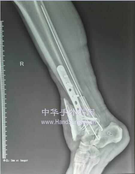 微信截图_20200507022122.png