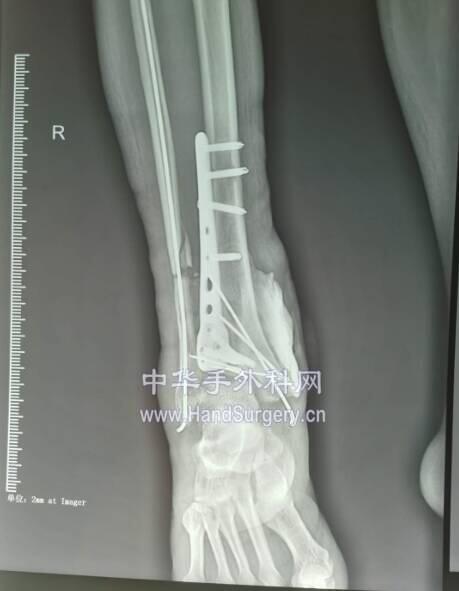 微信截图_20200507022135.png