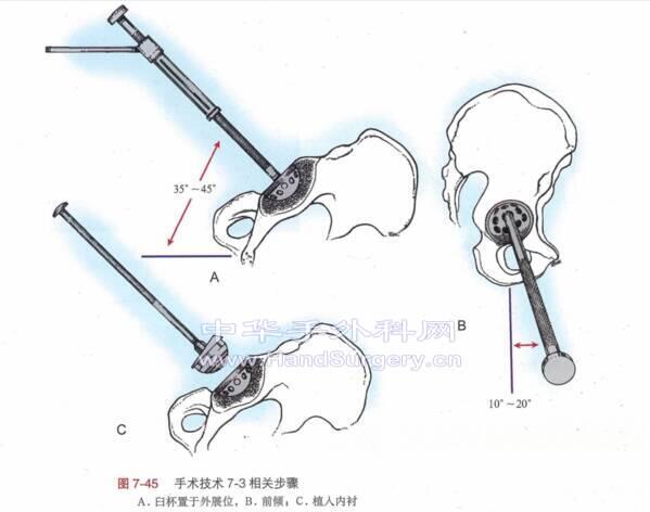 微信截图_20200615212419.png