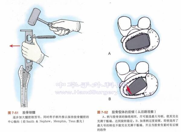 微信截图_20200615212640.png