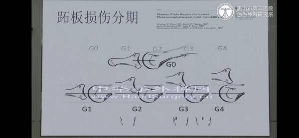 Screenshot_20200624_152136_com.tencent.mm.jpg