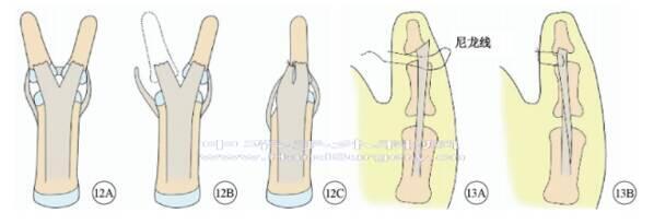 微信截图_20200822230142.png