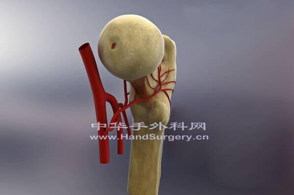 2-200G6115P3452.png