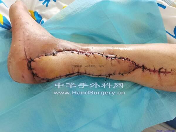 IMG_20200801_092740_极速看图.jpg