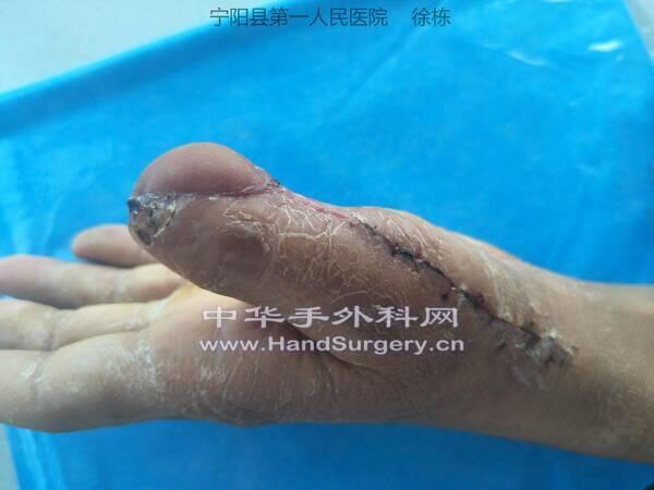 IMG20190916090737_极速看图.jpg
