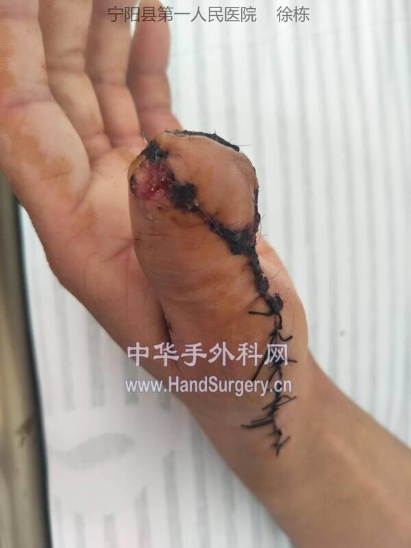 IMG20190826092228_极速看图.jpg
