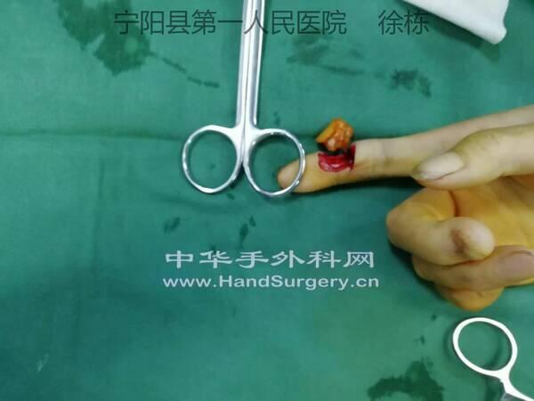 mmexport1509094982832_极速看图.jpg