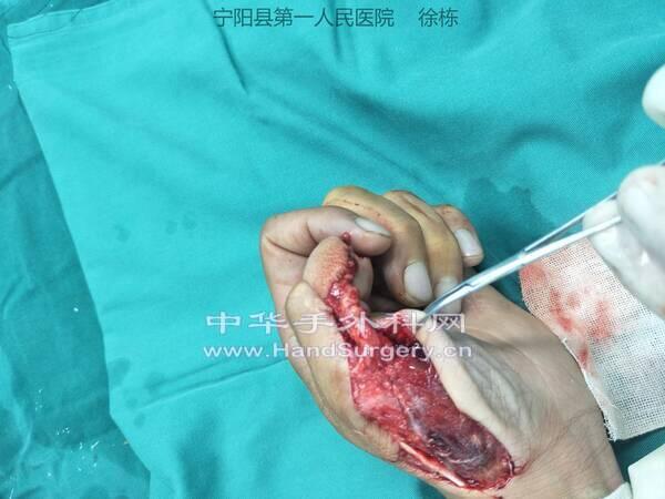 IMG20190816211658_极速看图.jpg