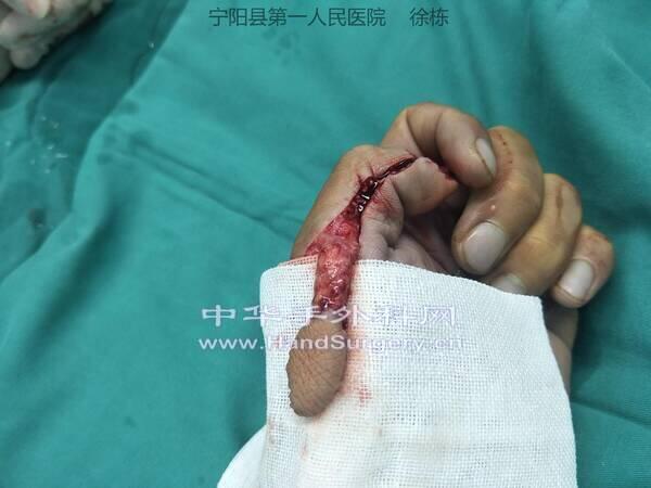 IMG20190816211601_极速看图.jpg
