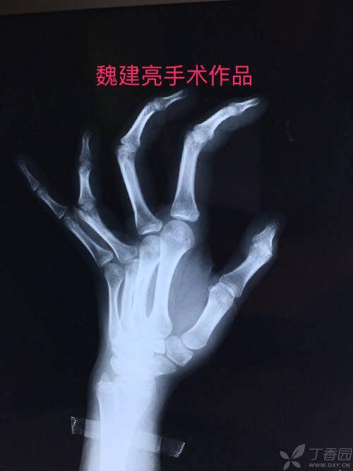 260519524315841533.jpg