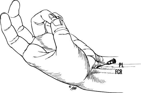 median nerve.JPG