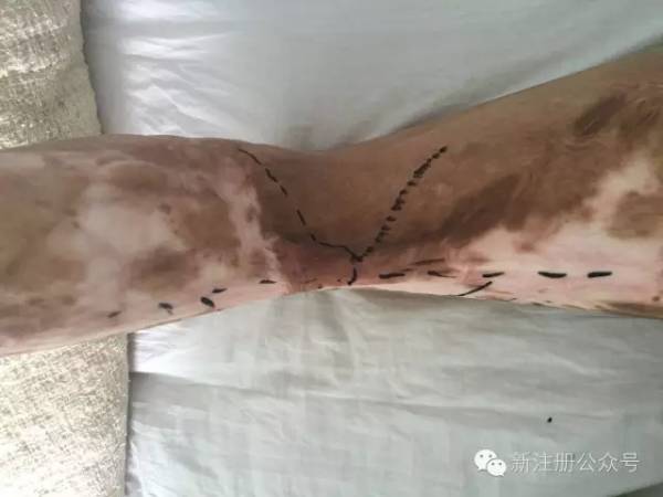 设计1