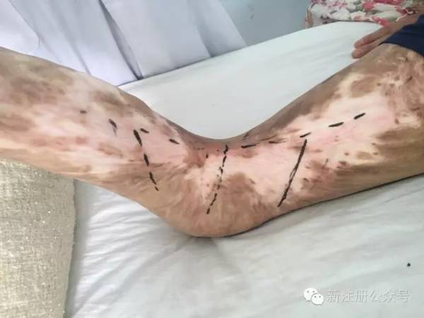 设计2