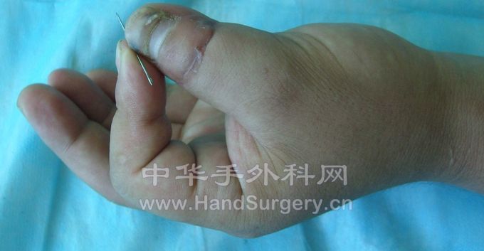 STP63099.JPG