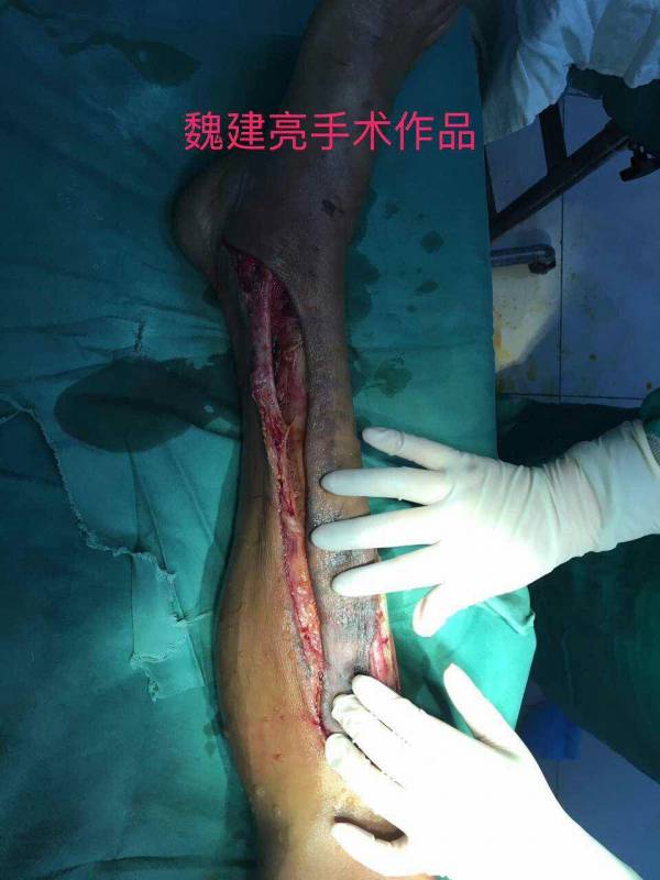 mmexport1501210101758.jpg