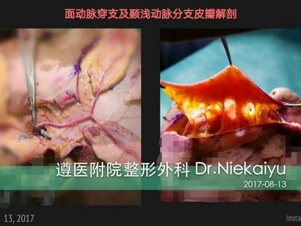 微信图片_20170817085153.jpg