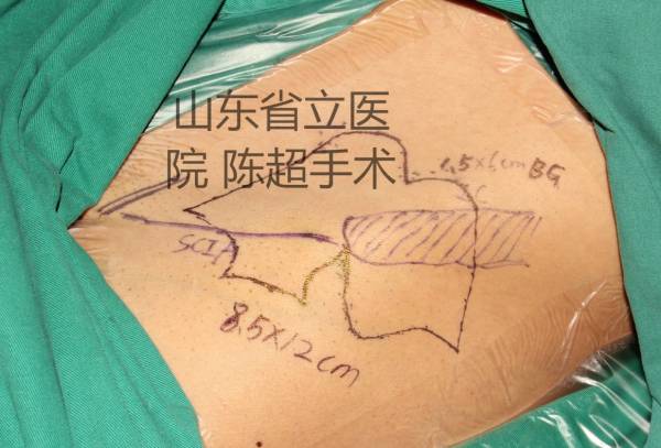 3_看图王.jpg
