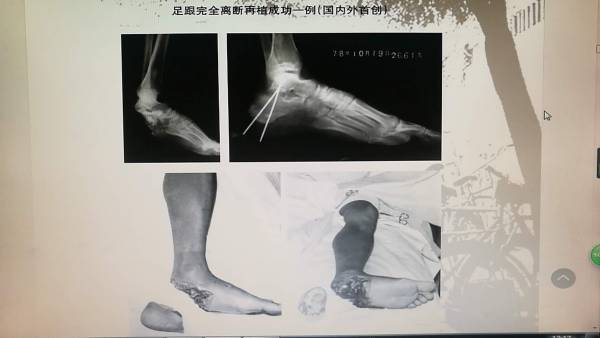 微信图片_20180202224843.jpg