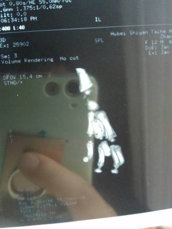 35左手.jpg
