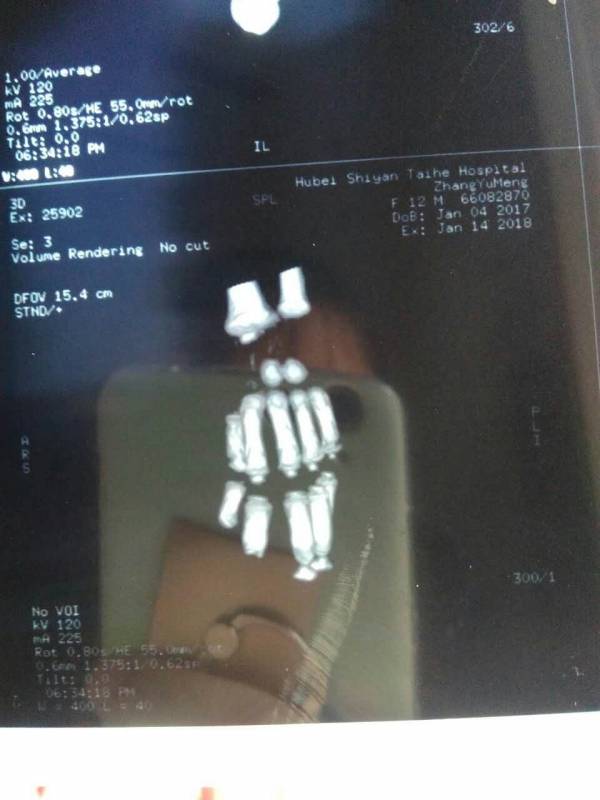 41左手.jpg
