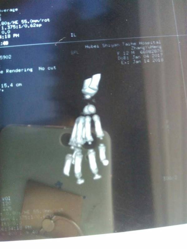 36左手.jpg