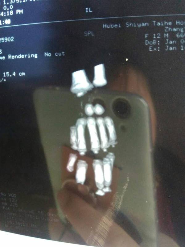 39左手.jpg