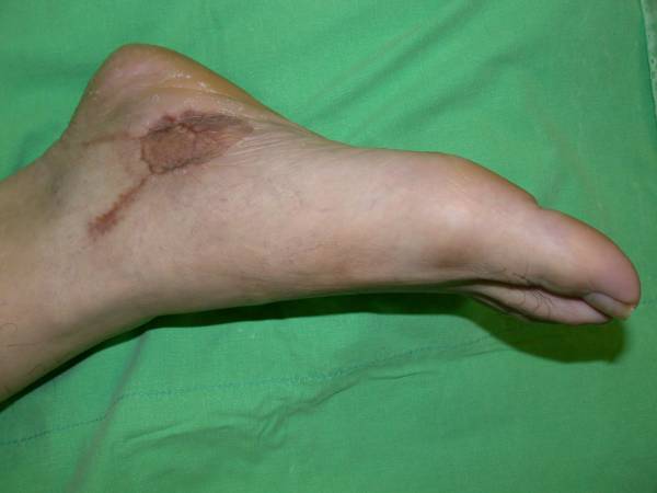 medplantar6.JPG