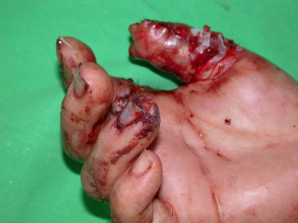 medplantar3.JPG
