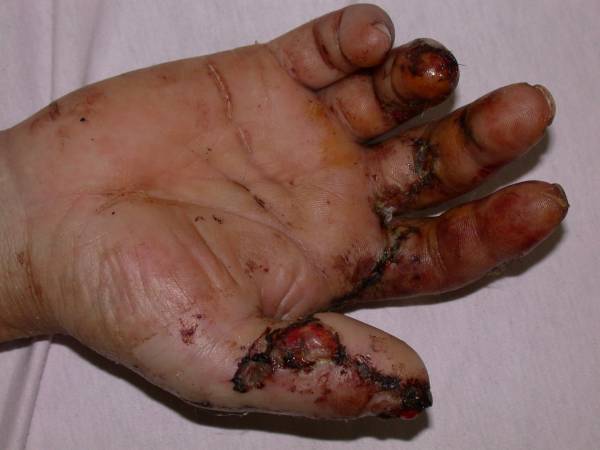 medplantar4.JPG