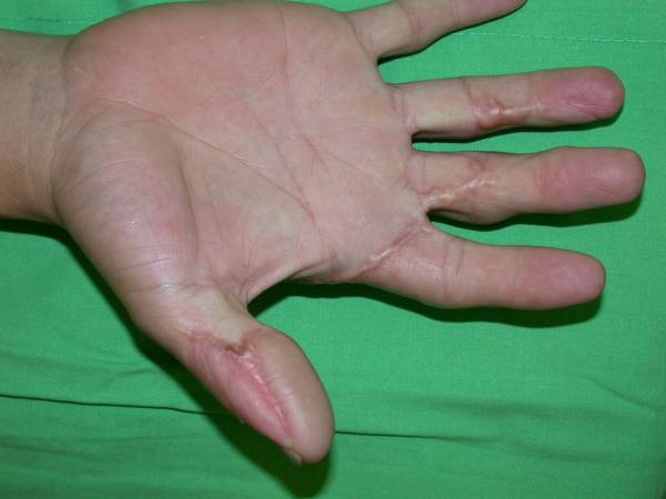 medplantar5.JPG
