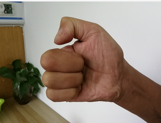 微信截图_20180418220256.png