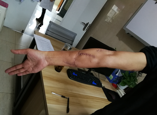 微信截图_20180418220218.png
