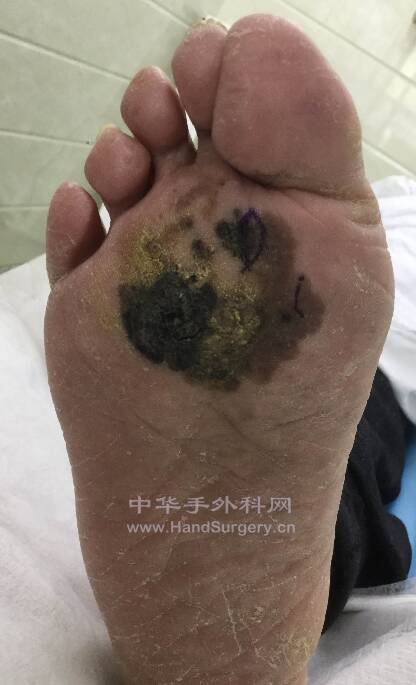 微信截图_20220404205816.png