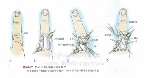 微信截图_20220519211741.png