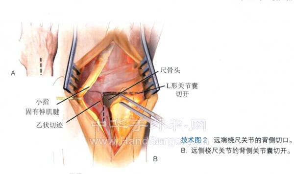 微信截图_20220519230005.png