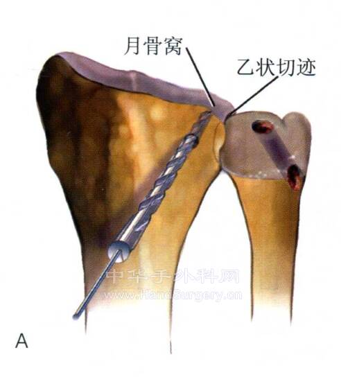 微信截图_20220519230308.png